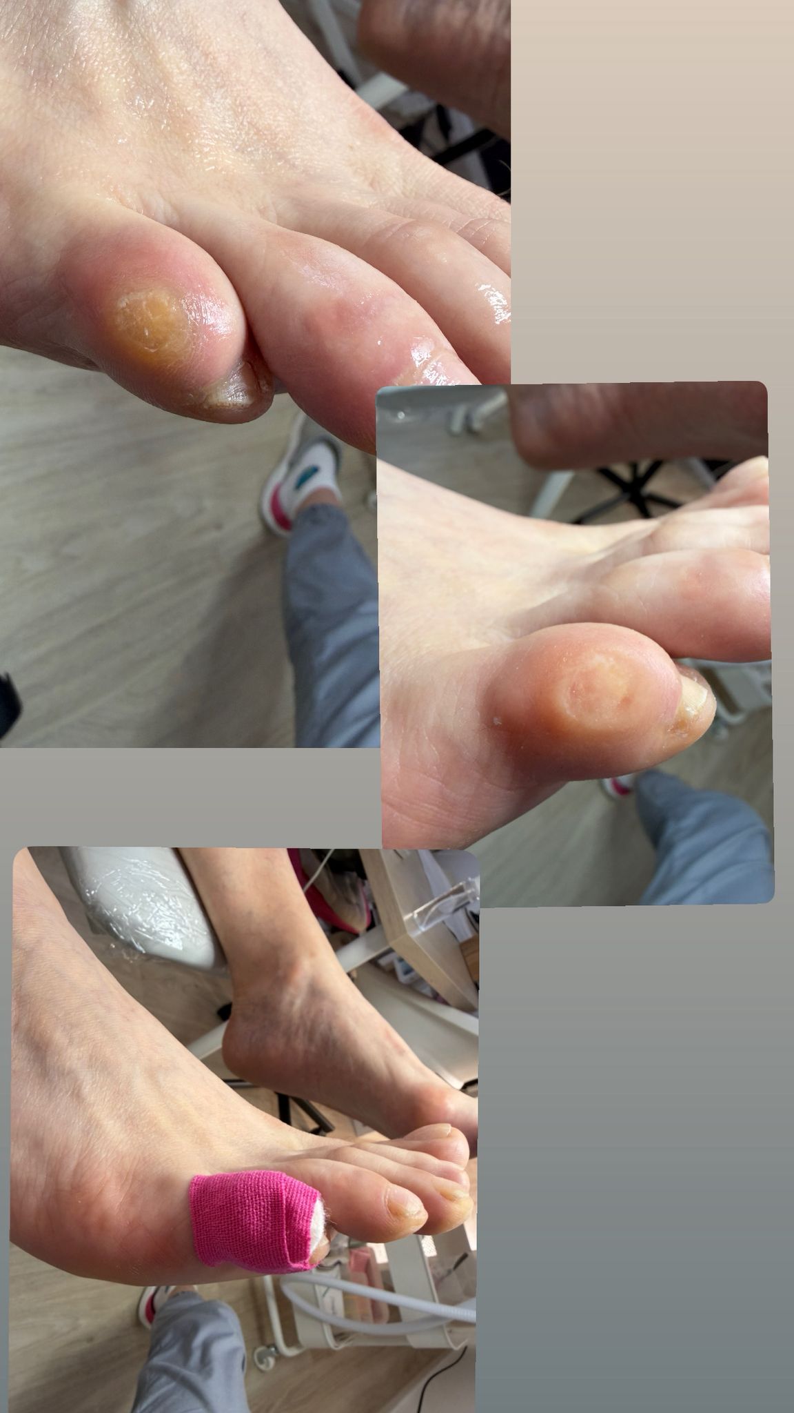 Fußpflege in Schneverdingen - Pflegesergebnis