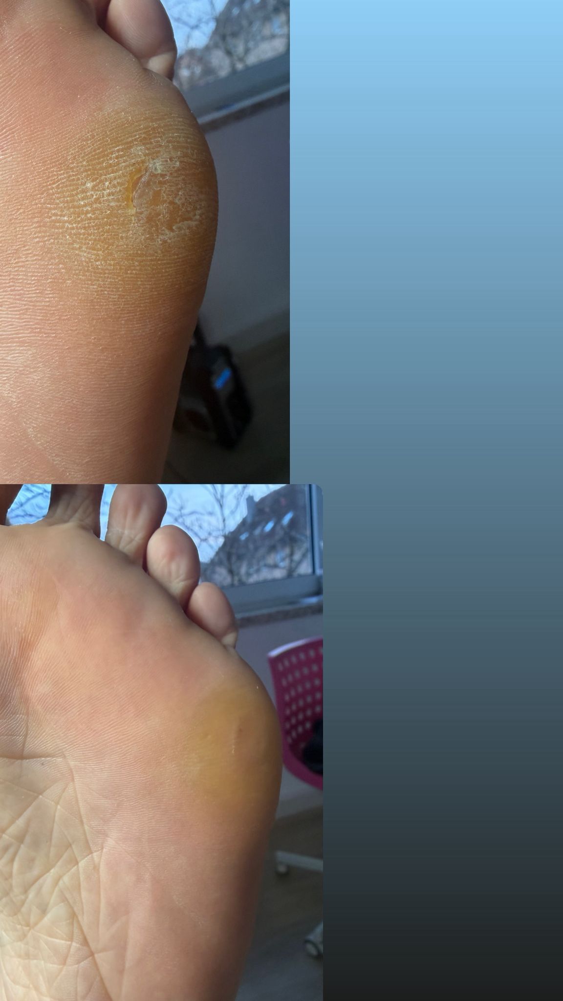 Fußpflege Galerie - Professionelle Pflege