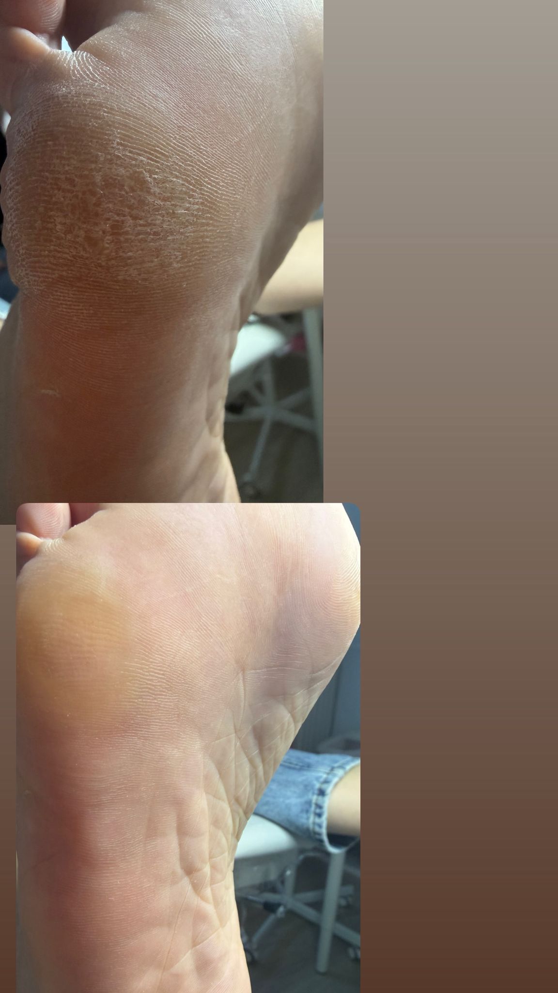 Nagelpflege Ergebnis - Fußpflege in Schneverdingen