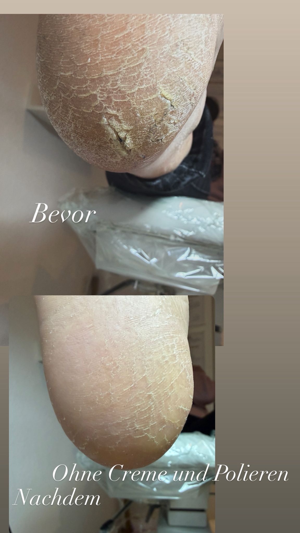 Präventive Fußpflege - Professionelle Pflege